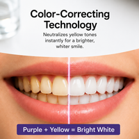 Purple Whitening Teeth Strips